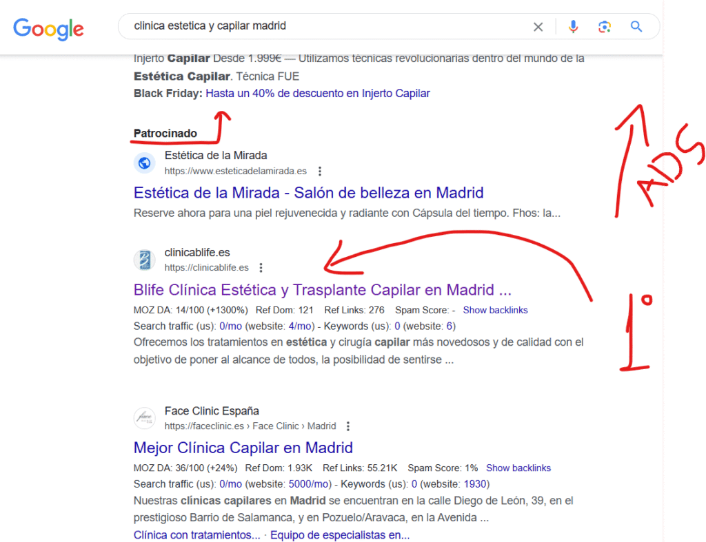 clinica estetica y de trasplante capilar en madrid