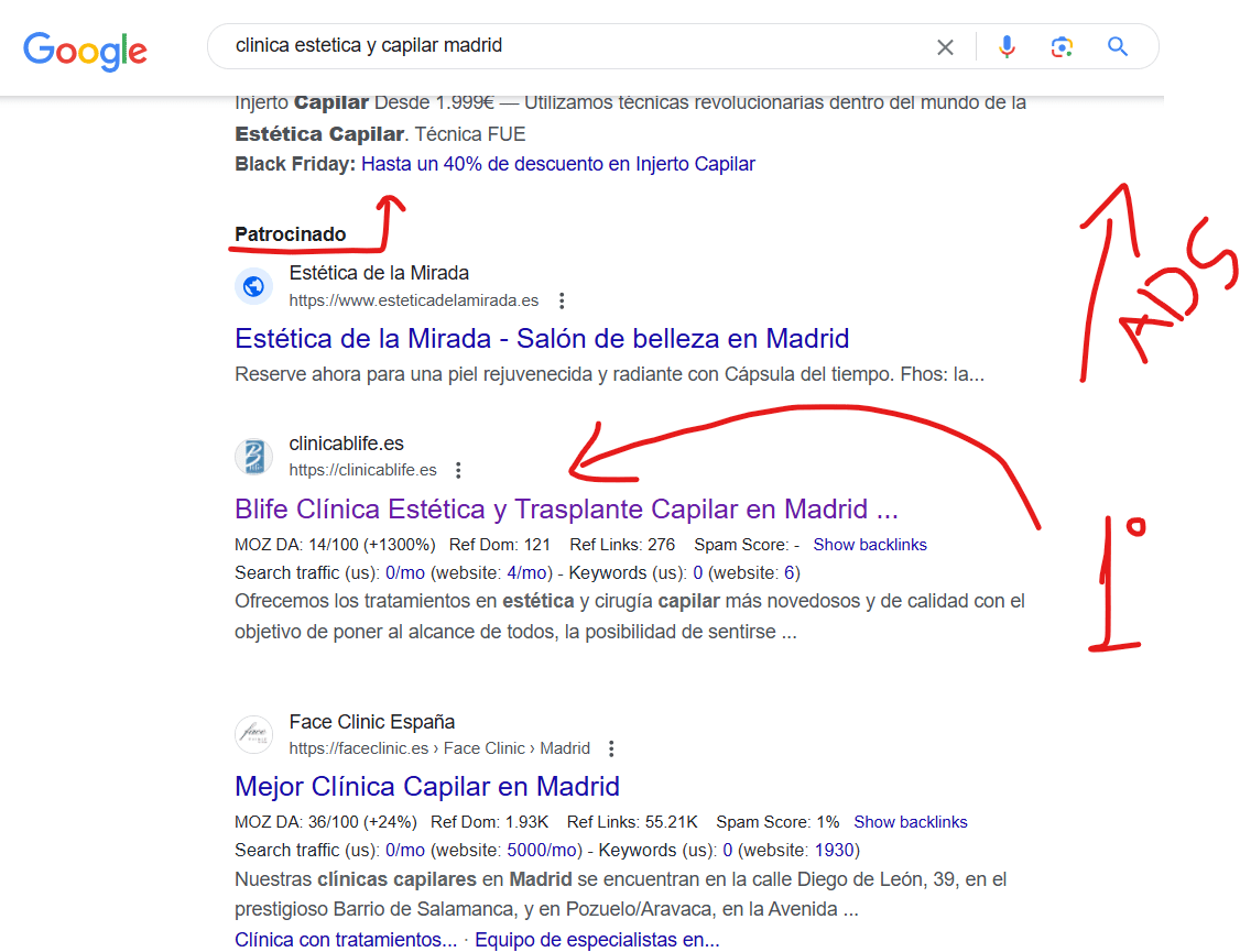 clinica estetica y de trasplante capilar en madrid